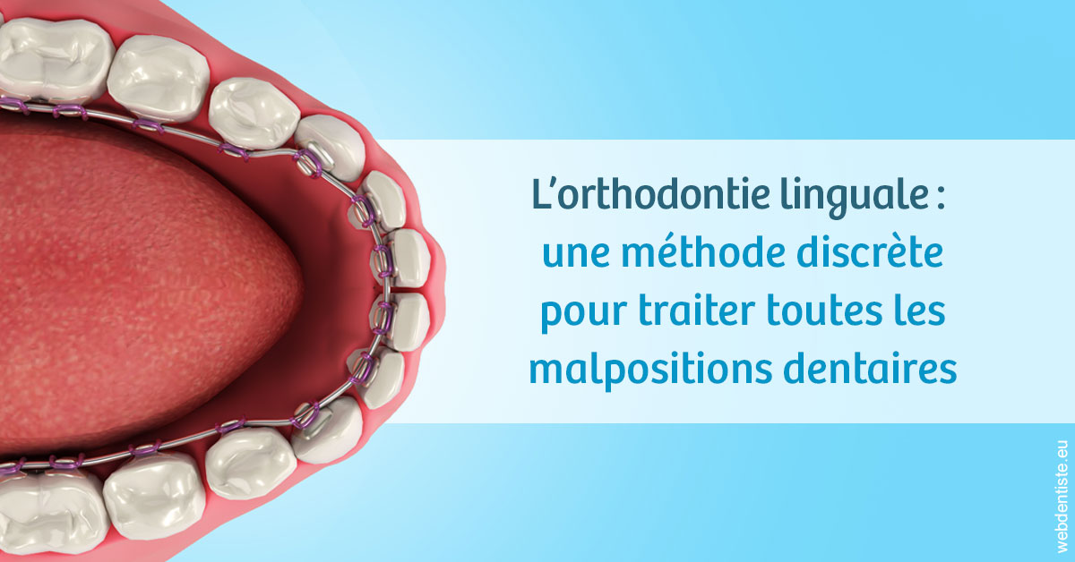 https://www.marcbodsondentiste.be/L'orthodontie linguale 1