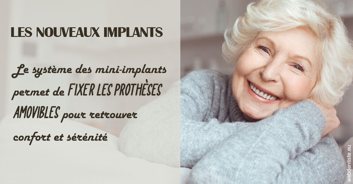 https://www.marcbodsondentiste.be/Les nouveaux implants 1