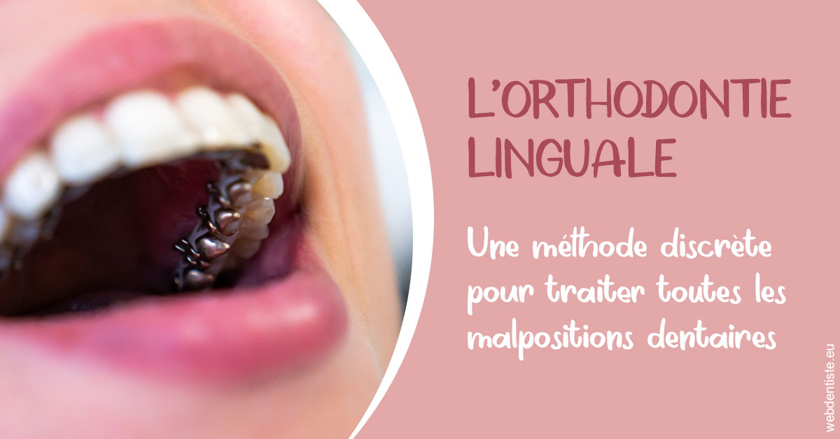 https://www.marcbodsondentiste.be/L'orthodontie linguale 2