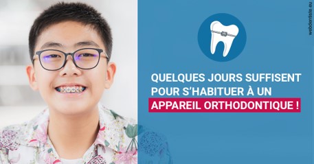 https://www.marcbodsondentiste.be/L'appareil orthodontique