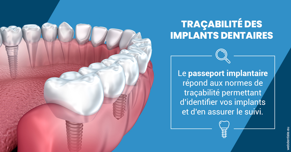 https://www.marcbodsondentiste.be/T2 2023 - Traçabilité des implants 1