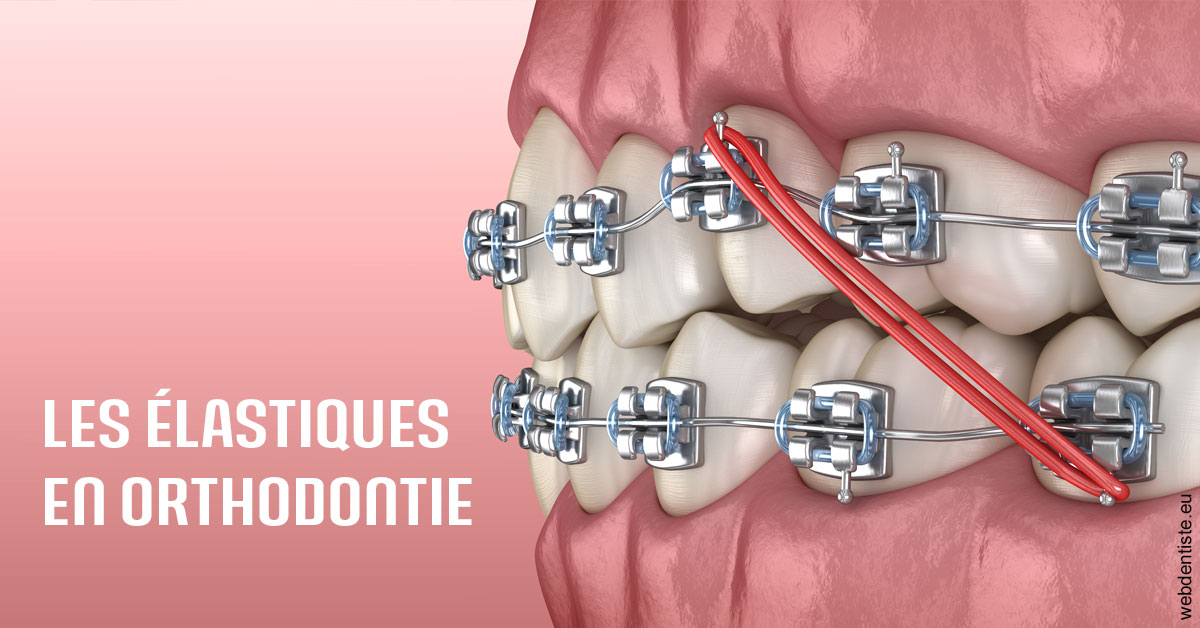 https://www.marcbodsondentiste.be/Elastiques orthodontie 2