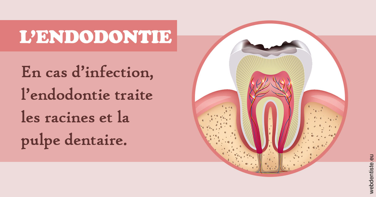 https://www.marcbodsondentiste.be/L'endodontie 2